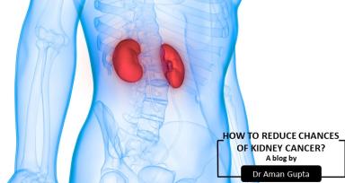 How To Reduce Chances of Kidney Cancer?